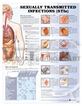 Sexually Transmitted Infections (STIs) Anatomical Chart